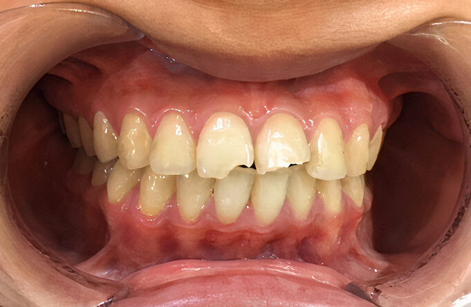 image3_auto_x2_colored_toned